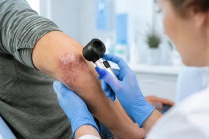 Psoriasis Pictures Types, Symptoms and What to Know